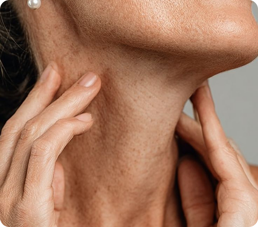 Collagen loss is invisible — until one day it isn't.